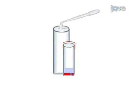 Cell Block Preparation from Cytology Specimen with Predominance of Individually Scattered Cells