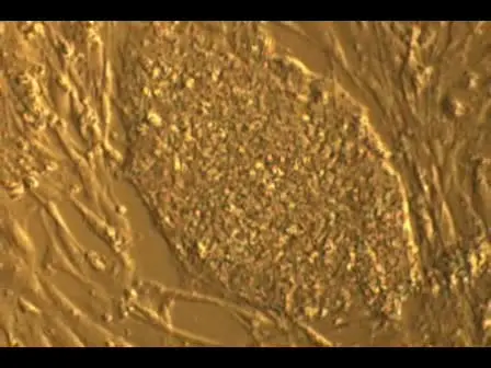 Chromosomal Spread Preparation of Human Embryonic Stem Cells for Karyotyping