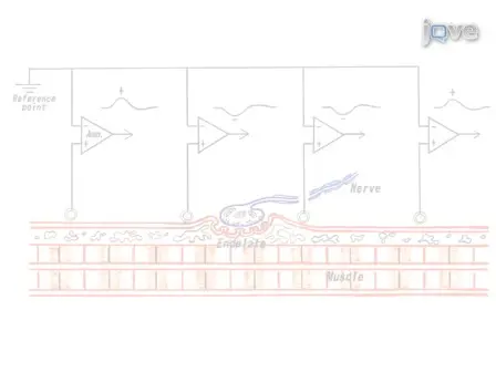 Extraction of the EPP Component from the Surface EMG