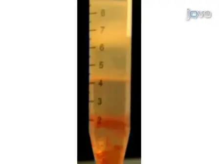 Neutrophil Extracellular Traps: How to Generate and Visualize Them