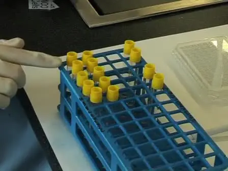 Measuring the 50% Haemolytic Complement (CH<sub>50</sub>) Activity of Serum