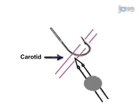 Mouse Models of Periventricular Leukomalacia