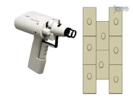 Bimolecular Fluorescence Complementation (BiFC) Assay for Protein-Protein Interaction in Onion Cells Using the Helios Gene Gun