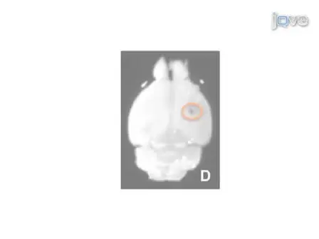 Establishing Intracranial Brain Tumor Xenografts With Subsequent Analysis of Tumor Growth and Response to Therapy using Bioluminescence Imaging