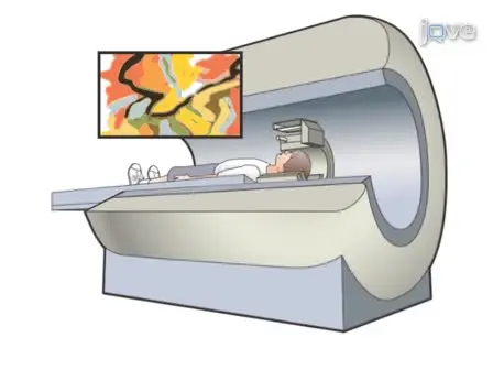 An Investigation of the Effects of Sports-related Concussion in Youth Using Functional Magnetic Resonance Imaging and the Head Impact Telemetry System