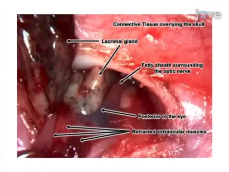 Optic Nerve Transection: A Model of Adult Neuron Apoptosis in the Central Nervous System