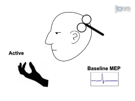 TMS: Using the Theta-Burst Protocol to Explore Mechanism of Plasticity in Individuals with Fragile X Syndrome and Autism