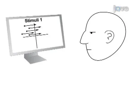 State-Dependency Effects on TMS:  A Look at Motive Phosphene Behavior