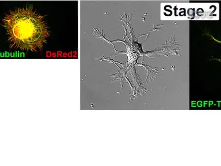 Nucleofection and Primary Culture of Embryonic Mouse Hippocampal and Cortical Neurons