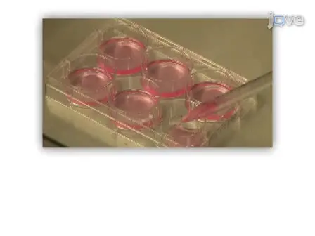 <em>Ex vivo</em> Expansion of Tumor-reactive T Cells by Means of Bryostatin 1/Ionomycin and the Common Gamma Chain Cytokines Formulation