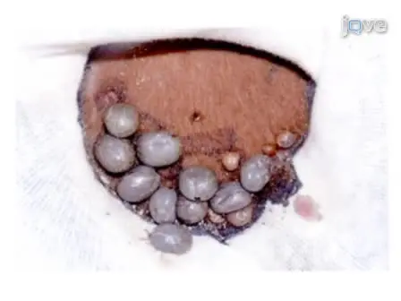 RNA Interference in Ticks