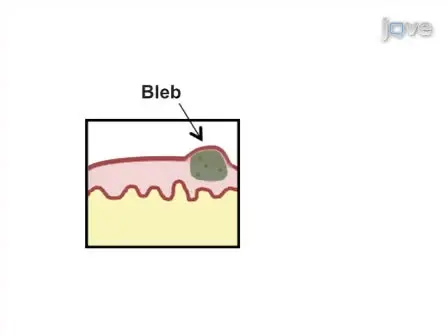 Mouse Bladder Wall Injection