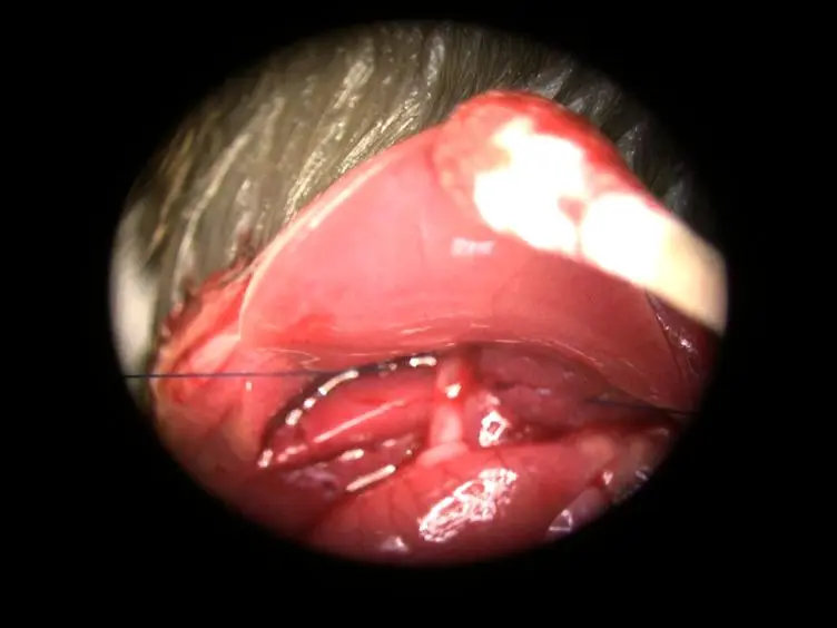 Use of a Hanging-weight System for Liver Ischemia in Mice