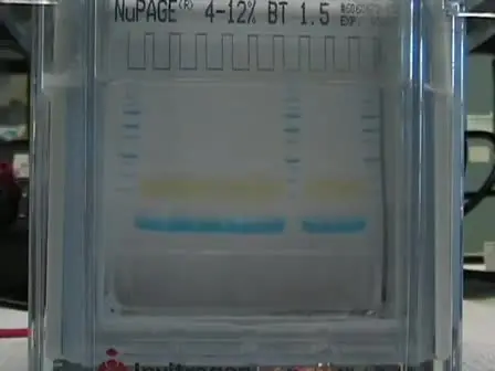 Western Blotting Using the Invitrogen NuPage Novex Bis Tris MiniGels