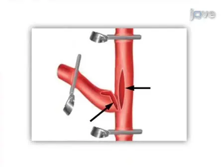 Microsurgical Venous Pouch Arterial-Bifurcation Aneurysms in the Rabbit Model: Technical Aspects