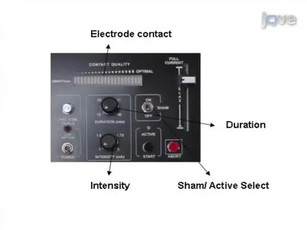 Electrode Positioning and Montage in Transcranial Direct Current Stimulation