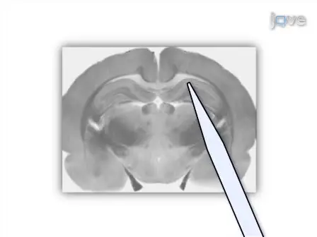 Vibrodissociation of Neurons from Rodent Brain Slices to Study Synaptic Transmission and Image Presynaptic Terminals