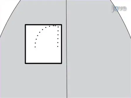 Preparing Undercut Model of Posttraumatic Epileptogenesis in Rodents