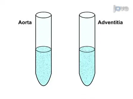 Flow Cytometry Analysis of Immune Cells Within Murine Aortas