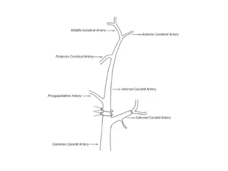 Intraluminal Middle Cerebral Artery Occlusion (MCAO) Model for Ischemic Stroke with Laser Doppler Flowmetry Guidance in Mice
