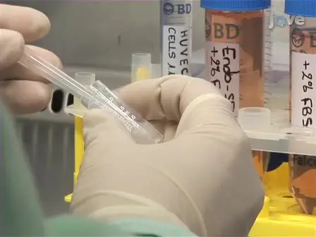 Introducing Shear Stress in the Study of Bacterial Adhesion