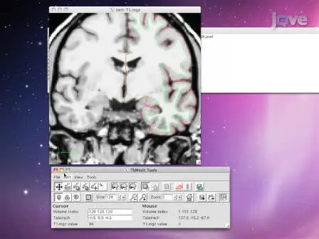 How to Measure Cortical Folding from MR Images: a Step-by-Step Tutorial to Compute Local Gyrification Index