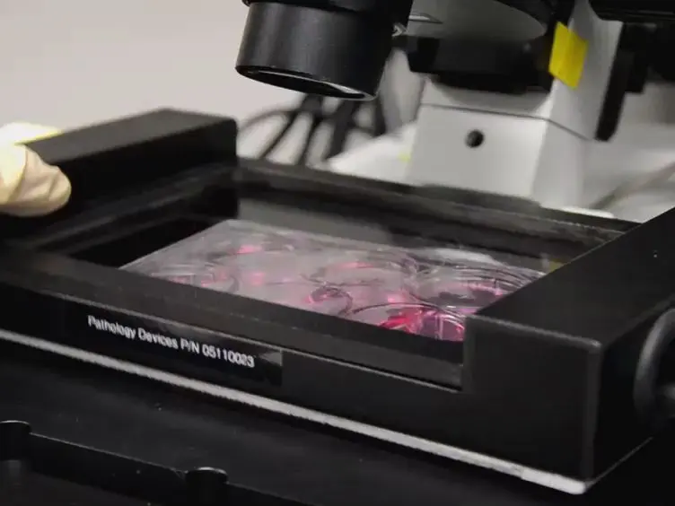 Quantitative Analysis of Random Migration of Cells Using Time-lapse Video Microscopy
