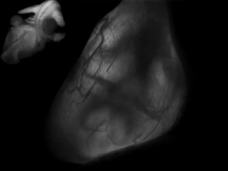 Gene Transfer to the Developing Mouse Inner Ear by <em>In Vivo</em> Electroporation