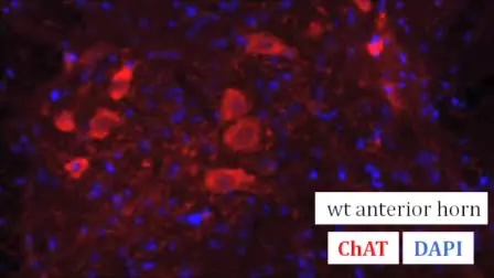 Clinical Testing and Spinal Cord Removal in a Mouse Model for Amyotrophic Lateral Sclerosis (ALS)