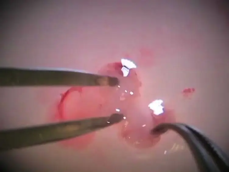 Isolation and Culture of Rat Embryonic Neural Cells: A Quick Protocol
