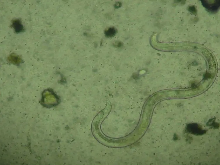 Determining Soil-transmitted Helminth Infection Status and Physical Fitness of School-aged Children
