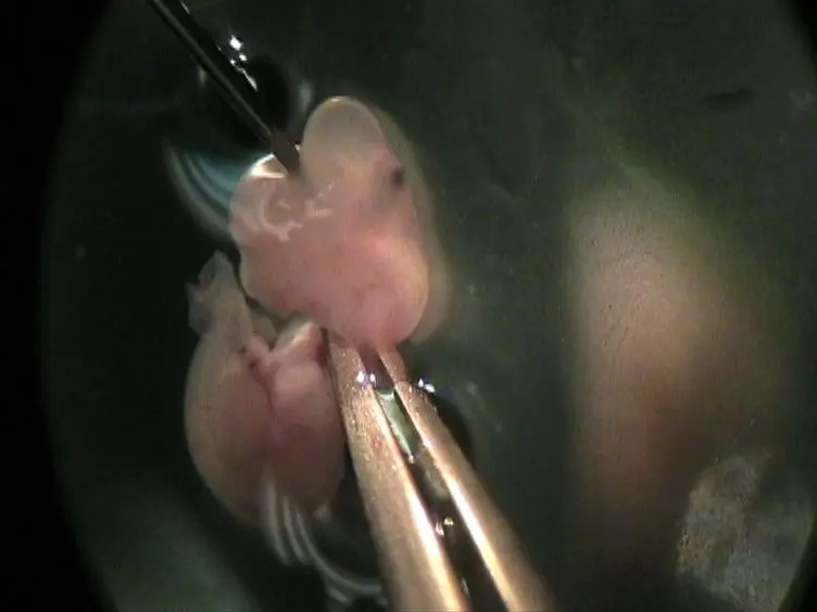 <em>In vitro</em> Electroporation of the Lower Rhombic Lip of Midgestation Mouse Embryos