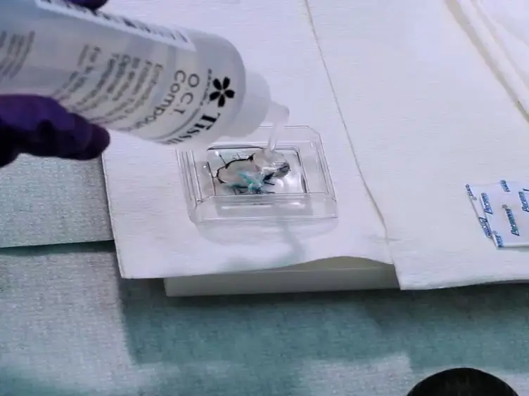 Collection Protocol for Human Pancreas