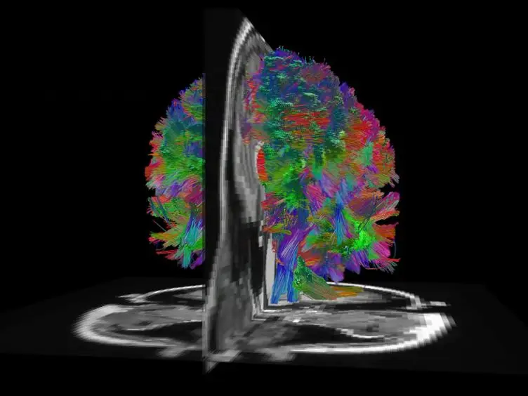 Co-analysis of Brain Structure and Function using fMRI and Diffusion-weighted Imaging