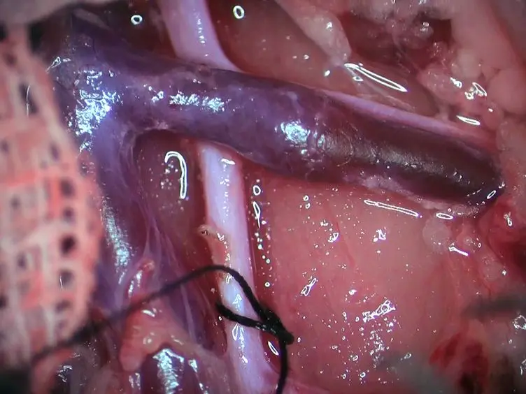 Non-invasive Imaging of Acute Allograft Rejection after Rat Renal Transplantation Using <sup>18</sup>F-FDG PET