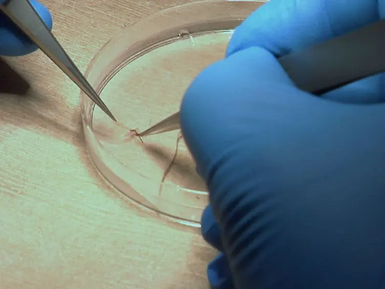 Orthotopic Aortic Transplantation in Mice for the Study of Vascular Disease