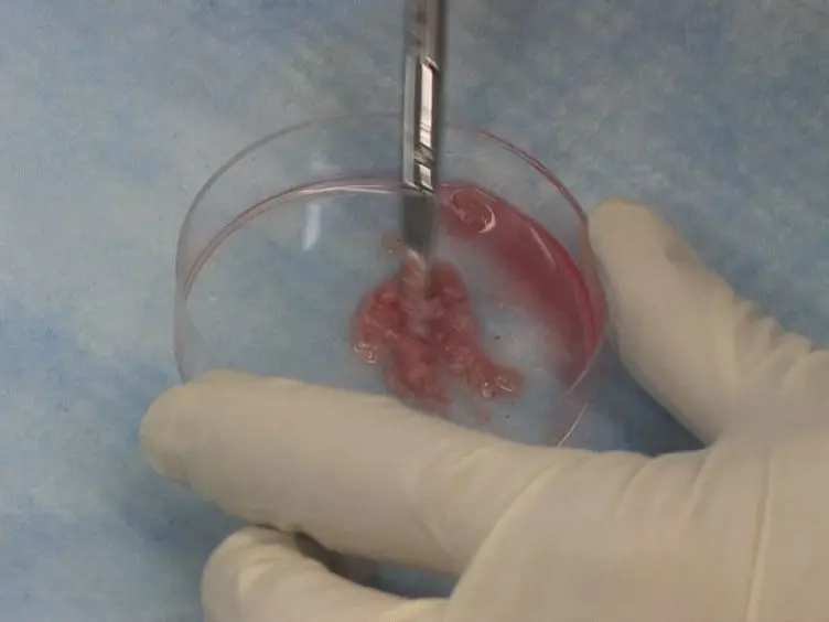 Isolation of Lymphocytes from Mouse Genital Tract Mucosa