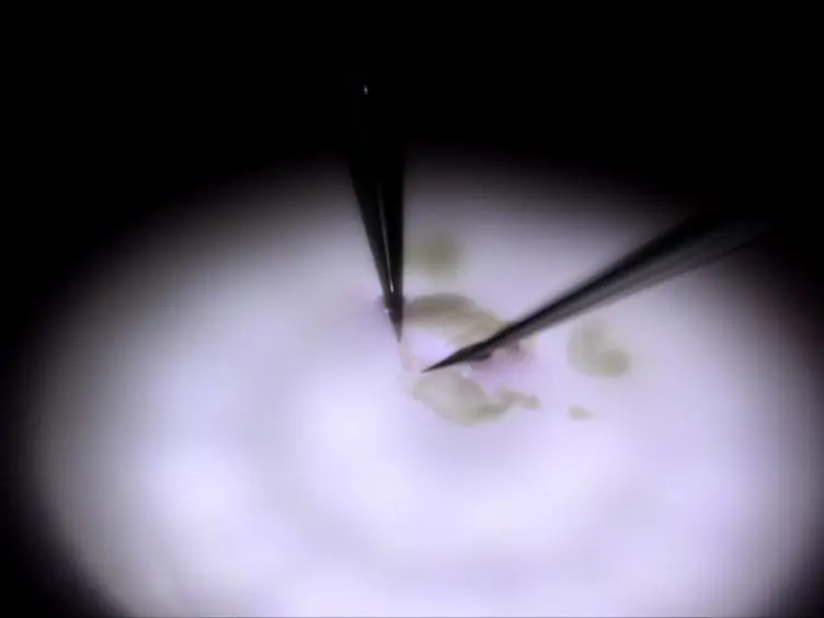 Imaging Analysis of Neuron to Glia Interaction in Microfluidic Culture Platform (MCP)-based Neuronal Axon and Glia Co-culture System
