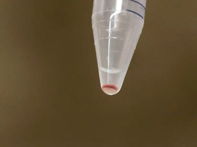 Trans-vivo Delayed Type Hypersensitivity Assay for Antigen Specific Regulation