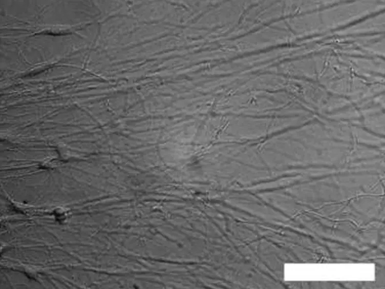 Analyzing Murine Schwann Cell Development Along Growing Axons