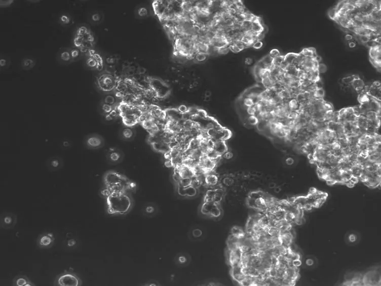 Serial Enrichment of Spermatogonial Stem and Progenitor Cells (SSCs) in Culture for Derivation of Long-term Adult Mouse SSC Lines