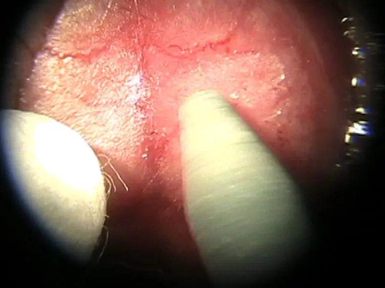 Thinned-skull Cortical Window Technique for <em>In Vivo</em> Optical Coherence Tomography Imaging