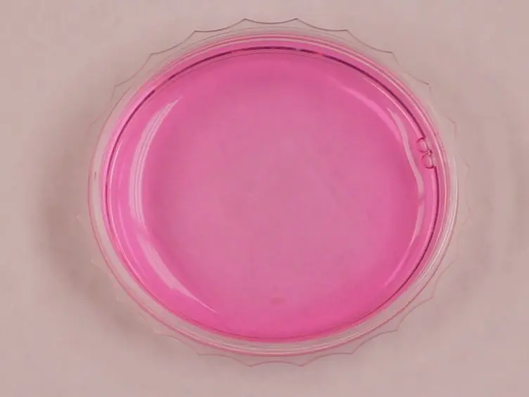 Visualization of Endoplasmic Reticulum Localized mRNAs in Mammalian Cells