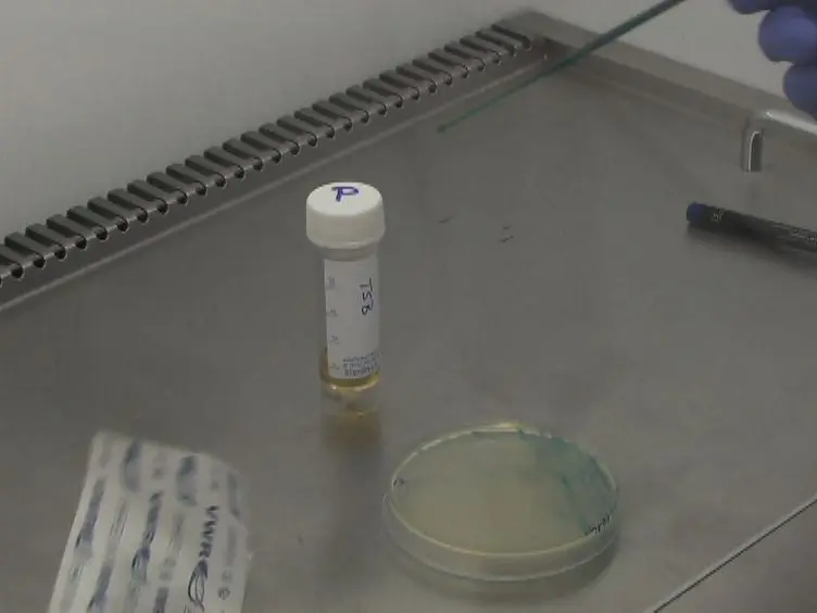 A Visual Assay to Monitor T6SS-mediated Bacterial Competition