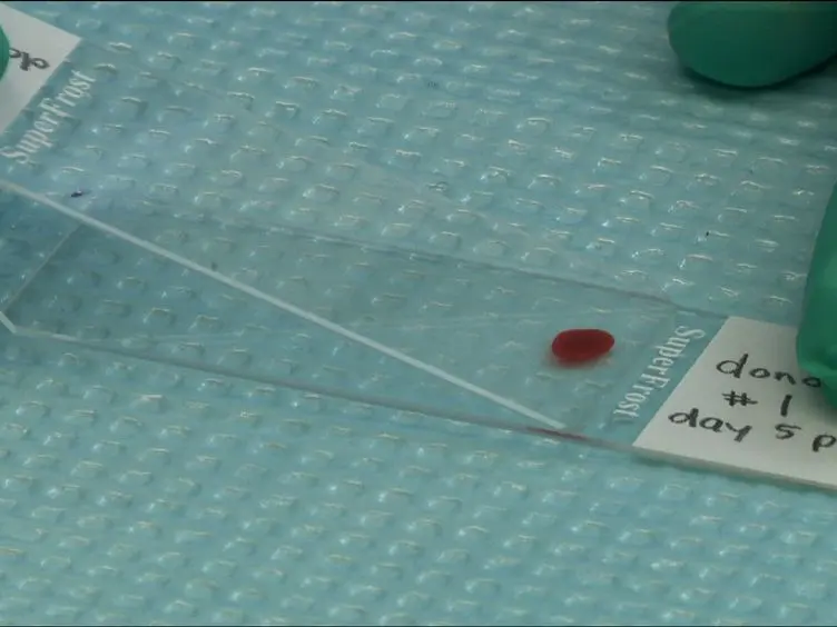 Isolation and Analysis of Brain-sequestered Leukocytes from <em>Plasmodium berghei</em> ANKA-infected Mice