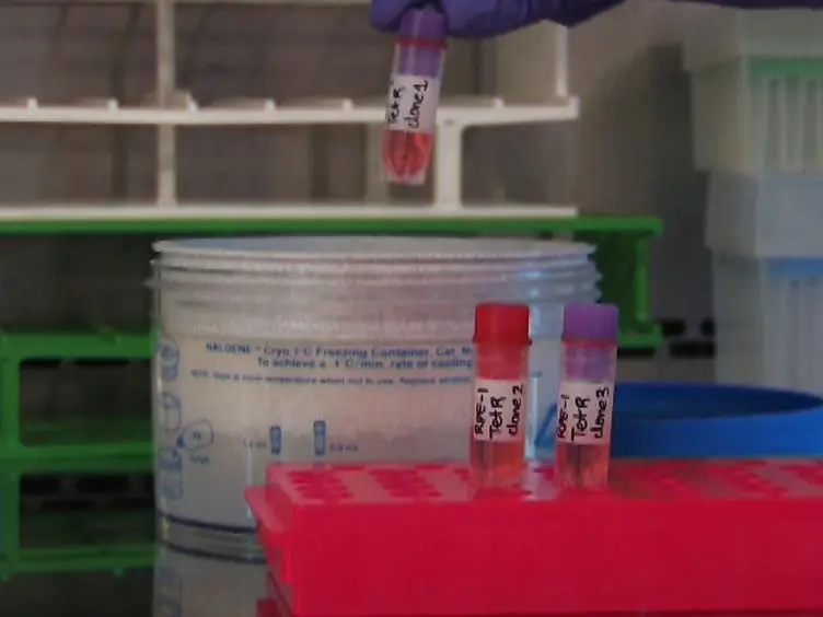 Generation of Stable Human Cell Lines with Tetracycline-inducible (Tet-on) shRNA or cDNA Expression