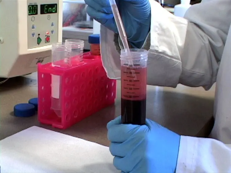 Micro-particle Image Velocimetry for Velocity Profile Measurements of Micro Blood Flows
