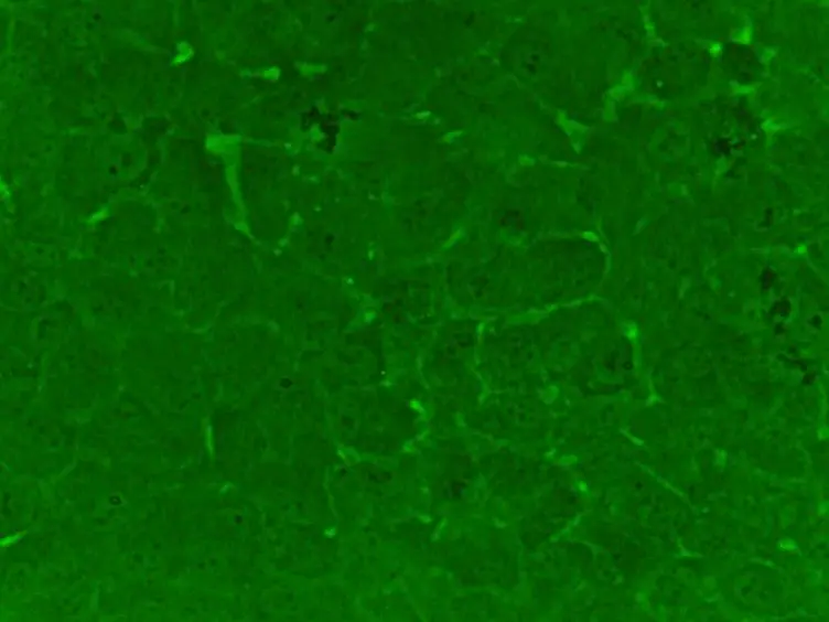 Mechanical Stimulation-induced Calcium Wave Propagation in Cell Monolayers: The Example of Bovine Corneal Endothelial Cells