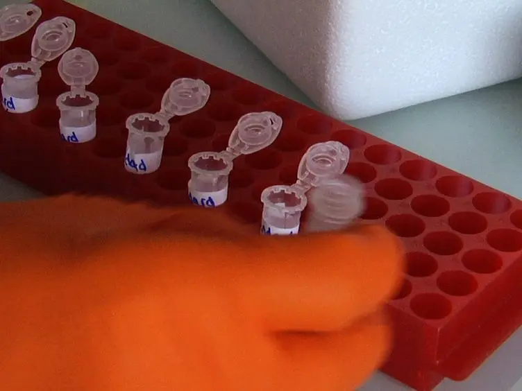 Biochemical Titration of Glycogen <em>In vitro</em>
