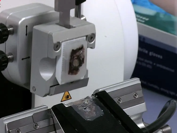 Proteomic Sample Preparation from Formalin Fixed and Paraffin Embedded Tissue
